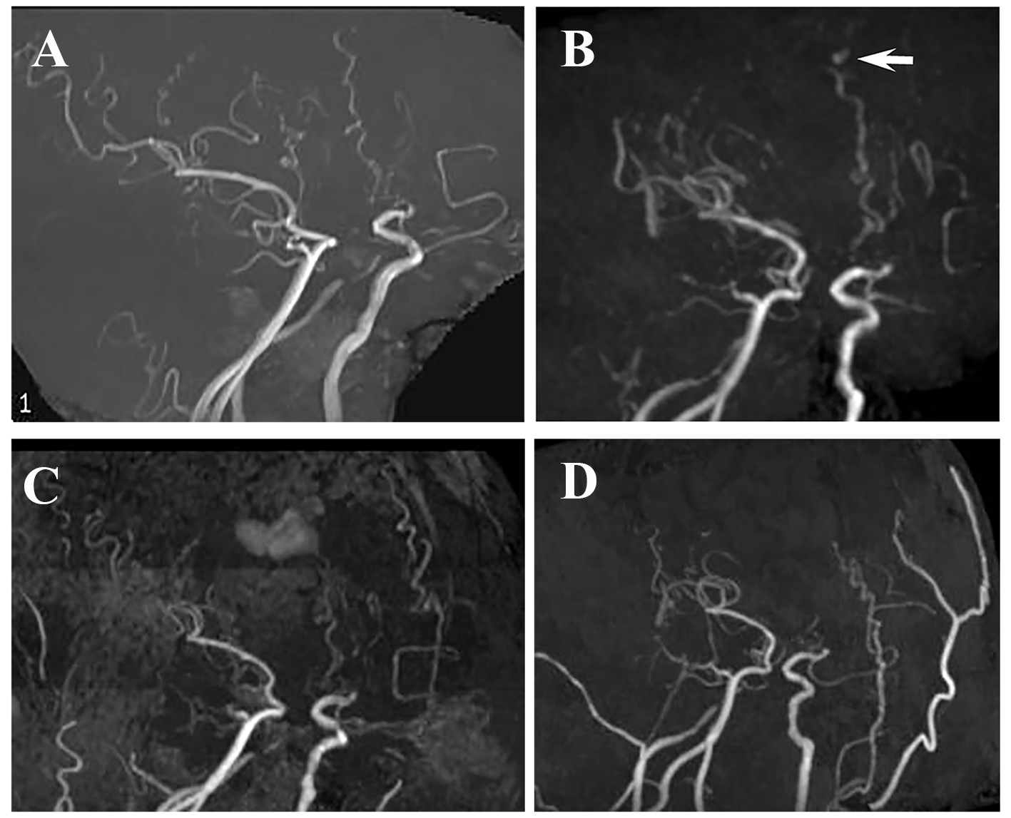 Figure 2. 