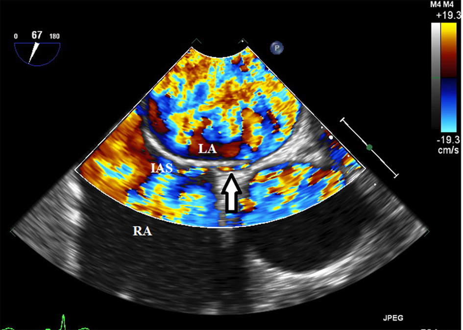 Figure 3. 