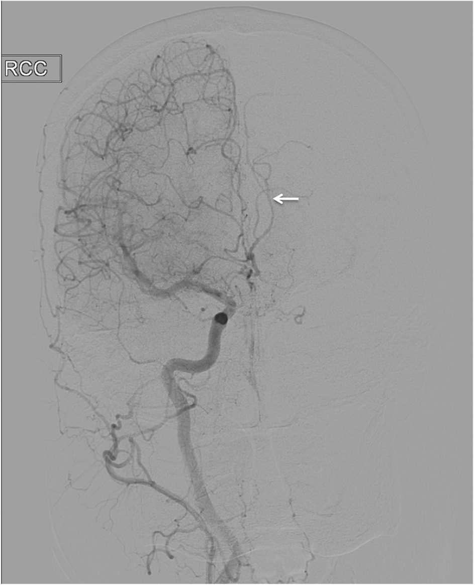 Figure 3. 