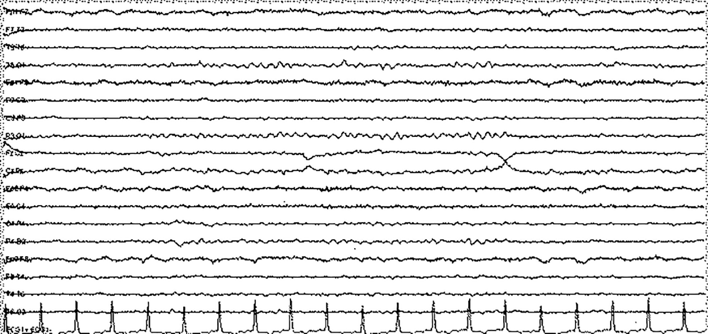 Figure 3. 