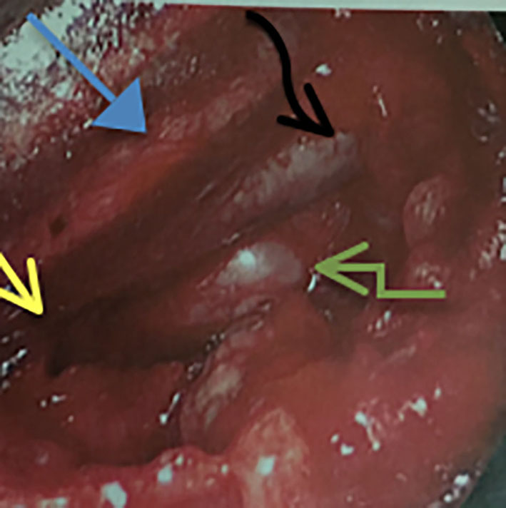 Figure 3. 