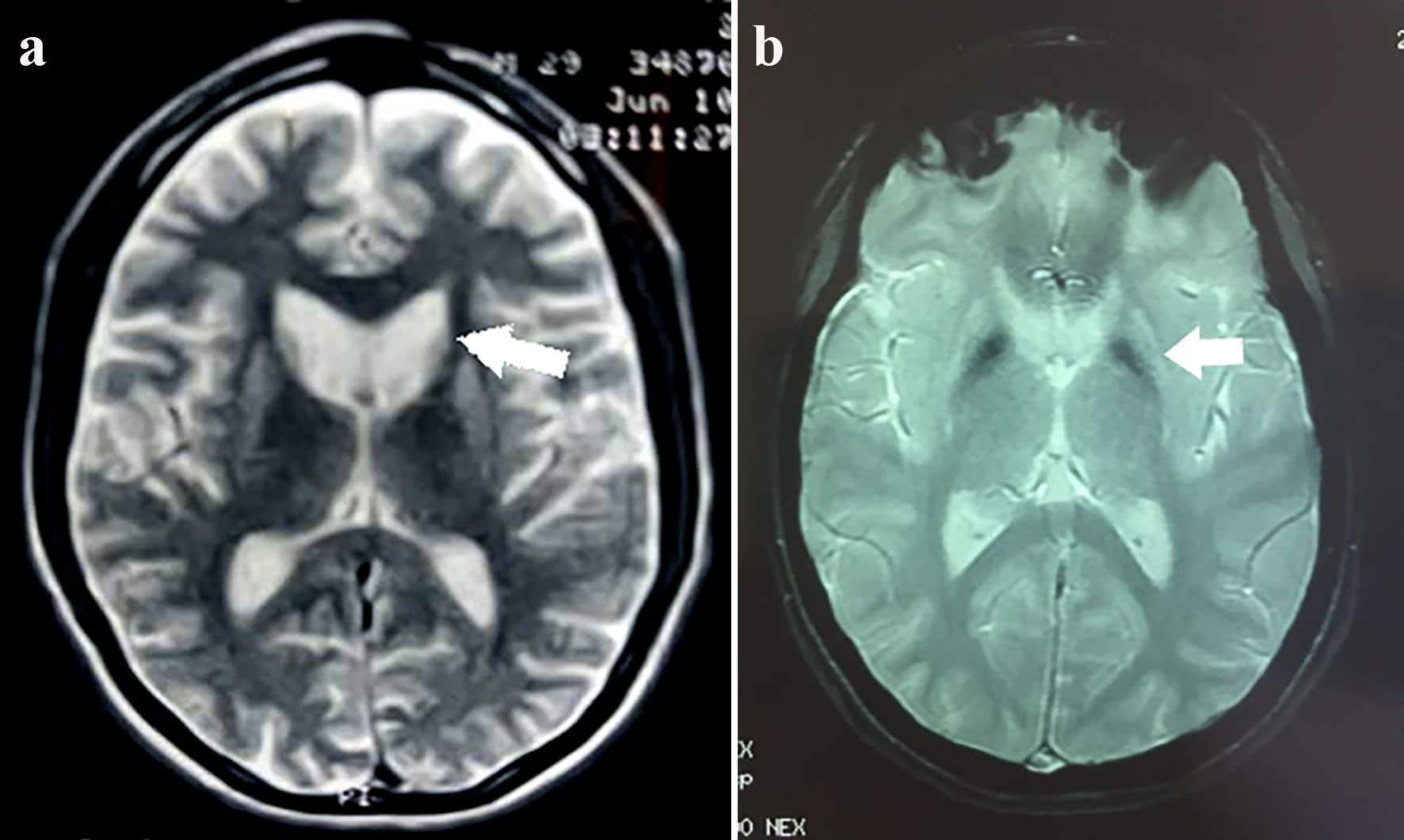 Figure 10. 